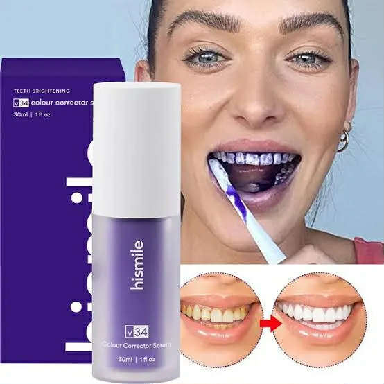 HiSmile V34 — পাশ থেকে দেখা